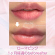 唇のお悩み解消いたします✨