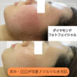 毛穴、凹凸、ハリ、シミが気になる方必見です✨