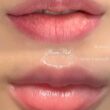 唇のメラニンケア✨ローマピンク